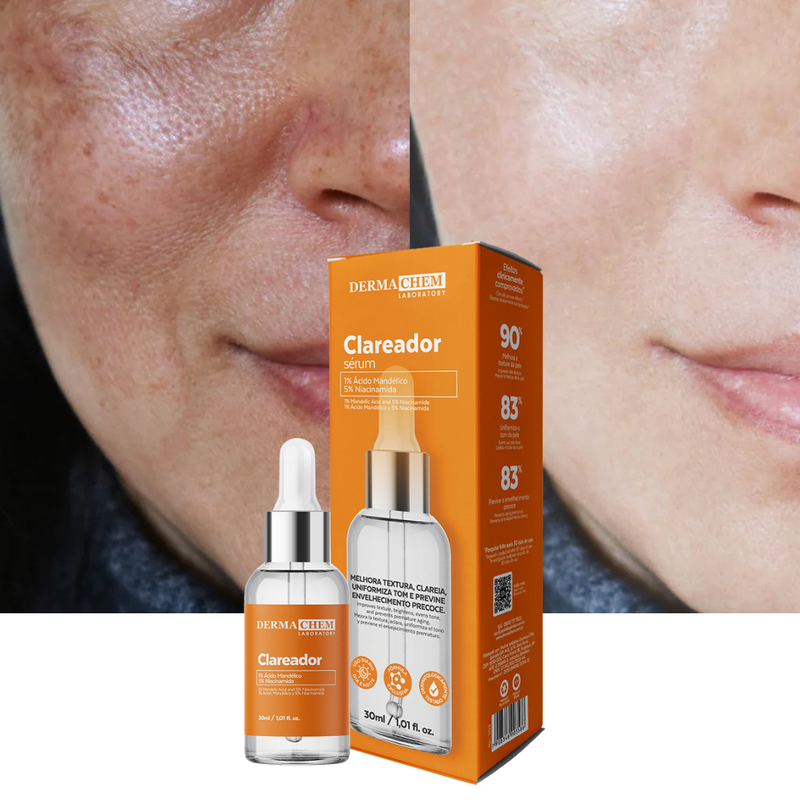 Sérum Clareador Dermachem de Melasma Uniformiza o tom da Pele Clareia Manchas Clareador Niacinamida